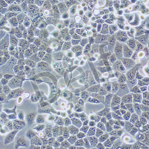 HEC-1-B 人子宮內(nèi)膜腺癌細胞