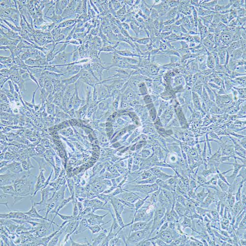 HEY A8 人卵巢癌細(xì)胞