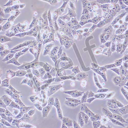 HGC-27 人胃癌細胞