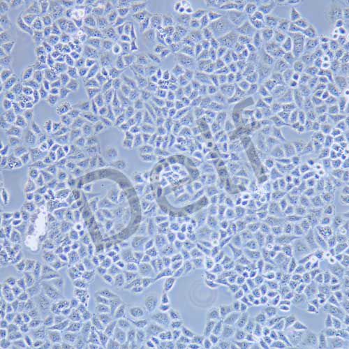 HO-8910PM 人高轉(zhuǎn)移卵巢癌細(xì)胞