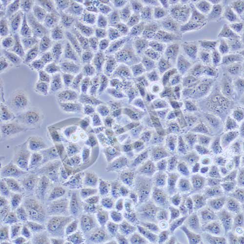 HO-8910PM 人高轉(zhuǎn)移卵巢癌細(xì)胞