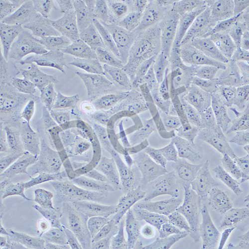HOS 人骨肉瘤細(xì)胞
