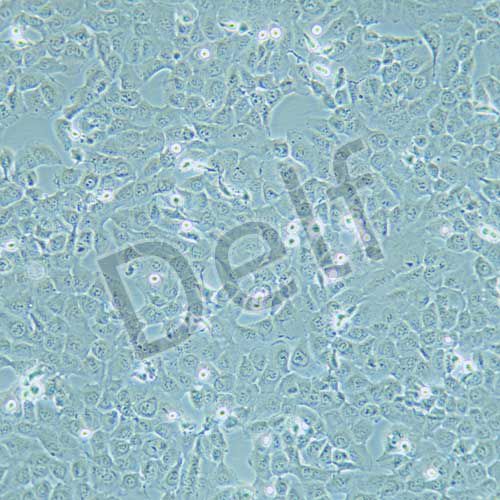 HT-1080 人纖維肉瘤細胞