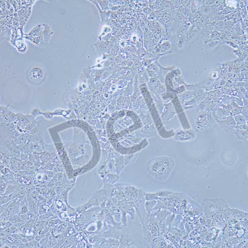 HT-1376 人膀胱癌細胞