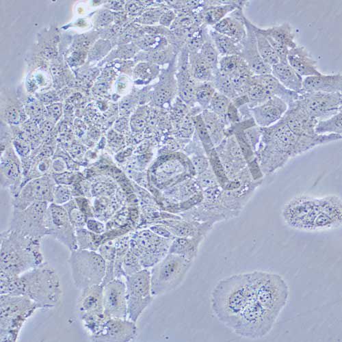 HT-1376 人膀胱癌細胞