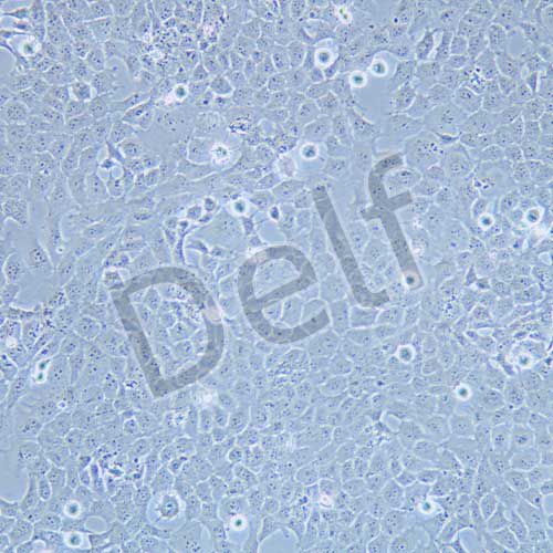 HTR-8/Svneo 人胚胎滋養(yǎng)細胞