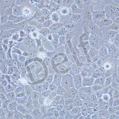 HTR-8/Svneo 人胚胎滋養(yǎng)細胞