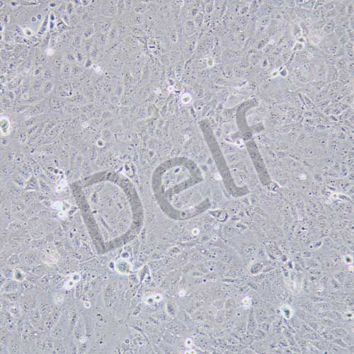 HuCCT1 人膽管癌細(xì)胞