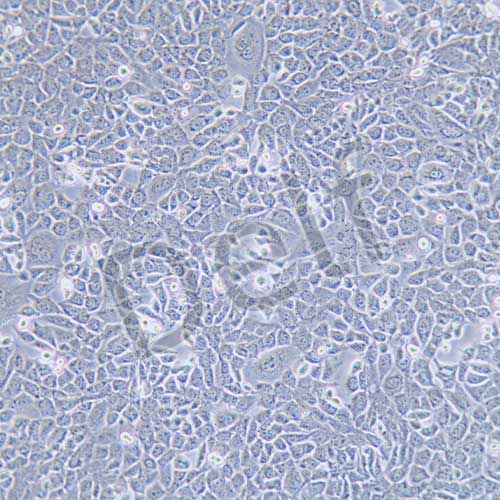 ID8 小鼠卵巢上皮癌細(xì)胞