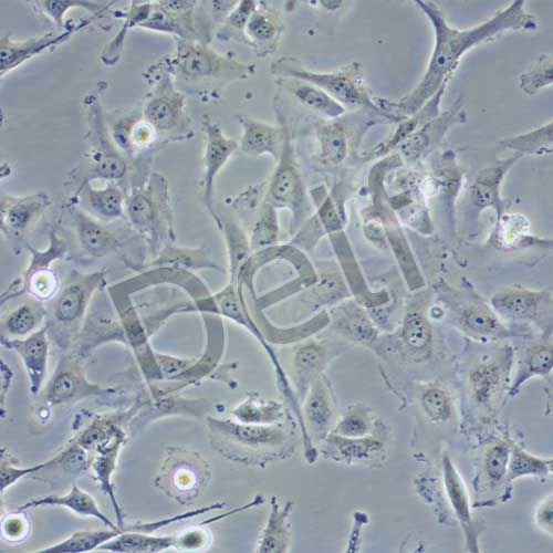 J82 人膀胱移行細胞癌