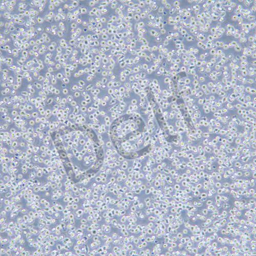 Jeko-1 人套細胞淋巴瘤細胞