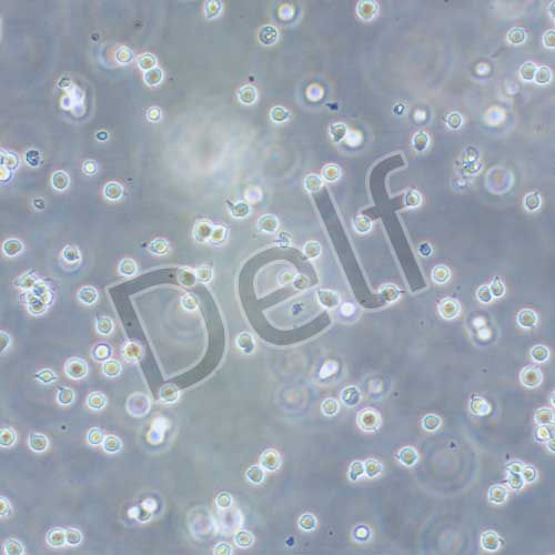 Jurkat(clone E6-1)人T淋巴細(xì)胞白血病細(xì)胞