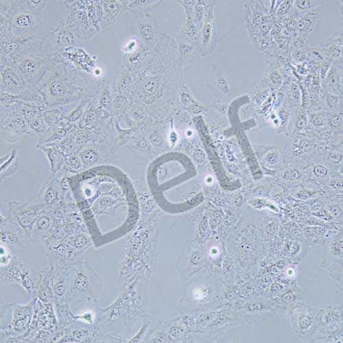 K1人甲狀腺癌細胞(暫不提供)