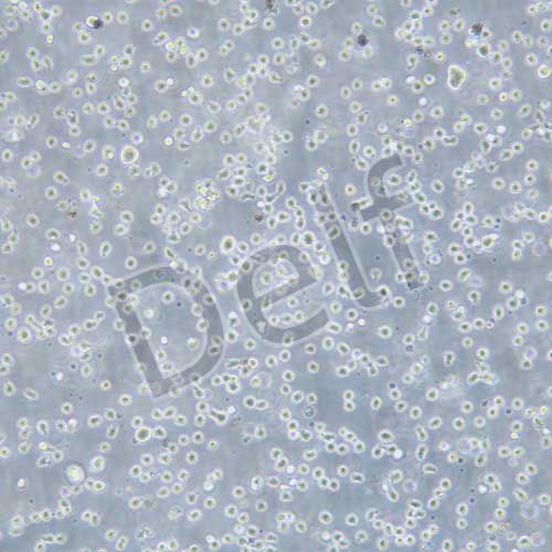 Karpas-299 人間變性大細胞淋巴瘤細胞