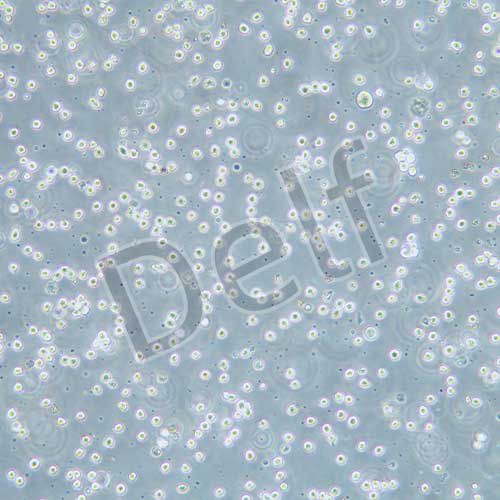 Kasumi-1 人紅白血病細胞