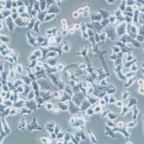 KB 人口腔表皮癌細(xì)胞