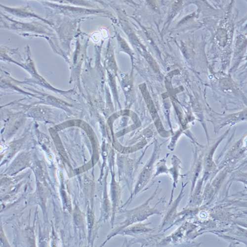 KGN 人卵巢顆粒細(xì)胞瘤細(xì)胞