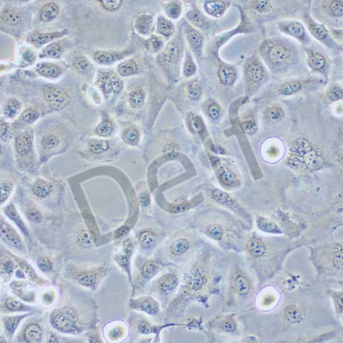 KLE 人子宮內(nèi)膜癌細(xì)胞