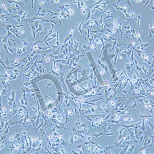 KNS-89 人腦膠質(zhì)瘤細(xì)胞