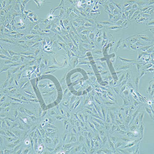 KTC-1 人甲狀腺癌細胞