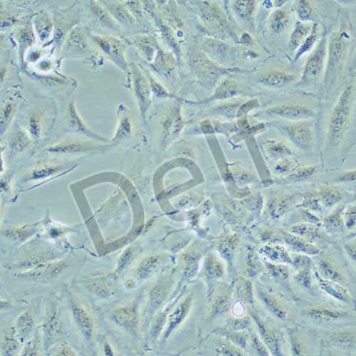 KTC-1 人甲狀腺癌細胞