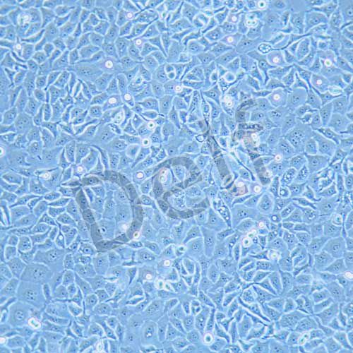 kyse30 人食道癌細(xì)胞