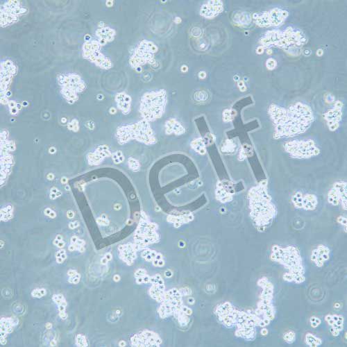 L5178Y TK 小鼠淋巴瘤細(xì)胞