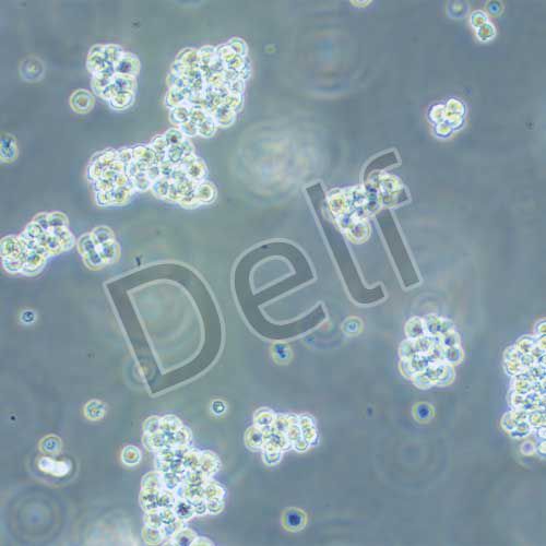 L5178Y TK 小鼠淋巴瘤細(xì)胞