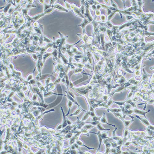 LNCaP clone FGC 人前列腺癌細胞
