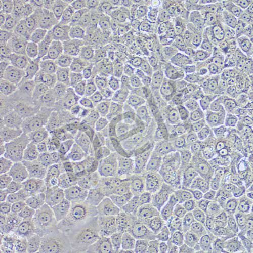 Mahlavu 人肝癌細(xì)胞