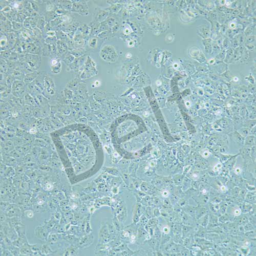 MCF-7/adr 人乳腺癌細胞阿霉素耐藥株