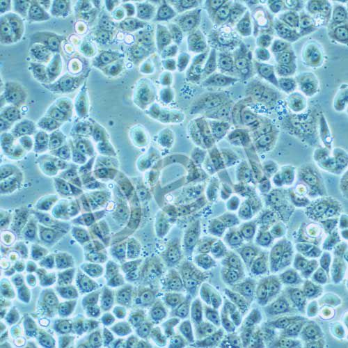 MDA-MB-468 人乳腺癌細胞