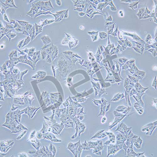 MDA-MB-361 人乳腺癌細胞