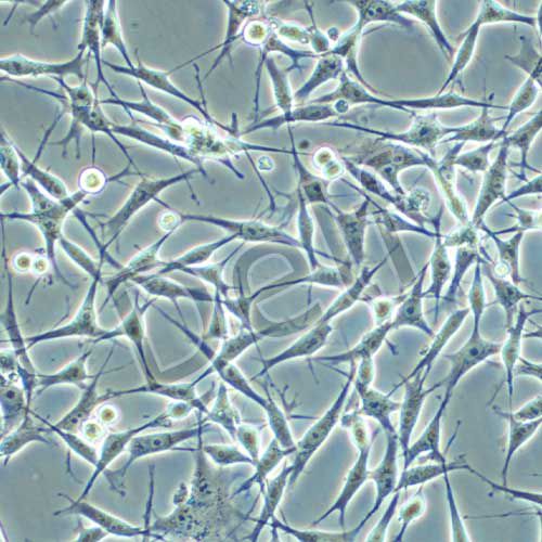 MDA-MB-435s 人黑色素瘤細(xì)胞/人乳腺癌細(xì)胞