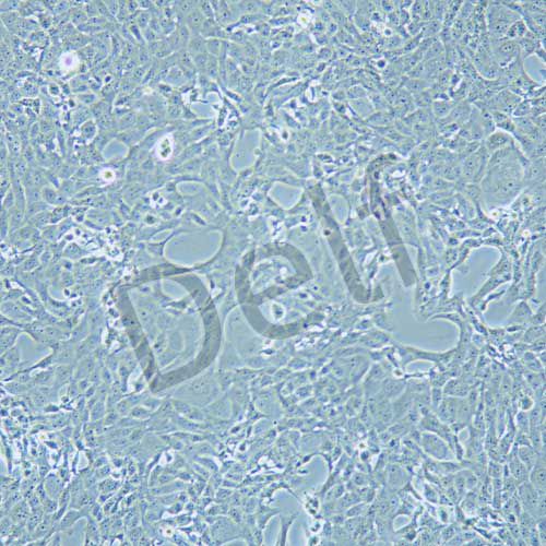 MDBK NBL-1 牛腎細胞