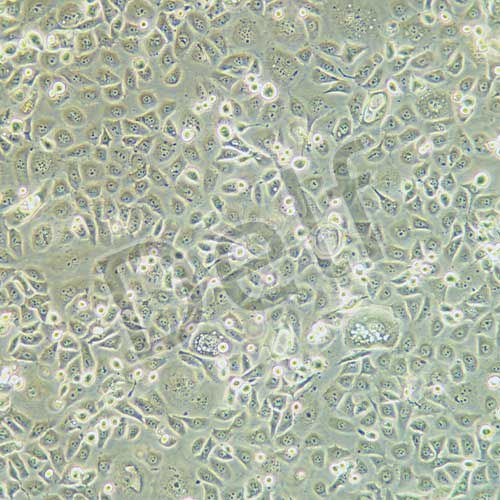ME-180 人子宮頸表皮癌細胞