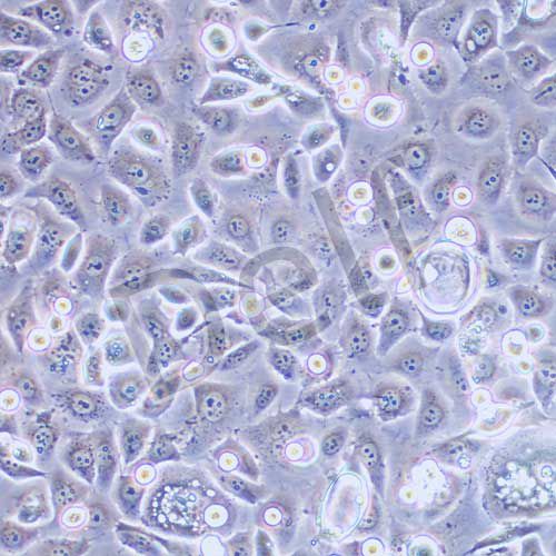 ME-180 人子宮頸表皮癌細胞