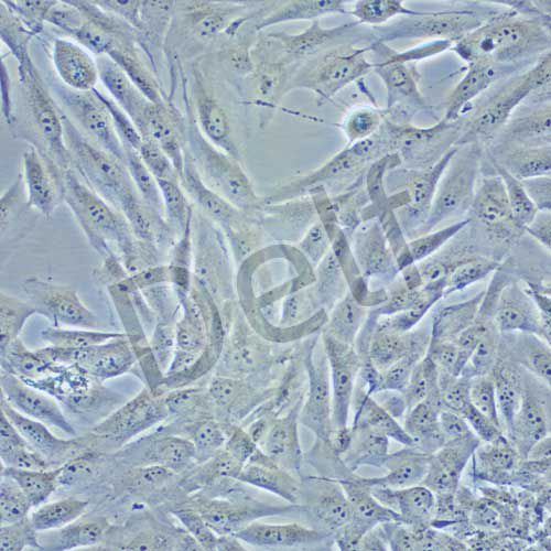 MG-63 人骨肉瘤細(xì)胞