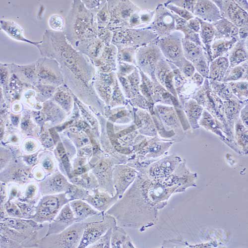 MHCC-97H 人高轉移性肝癌細胞