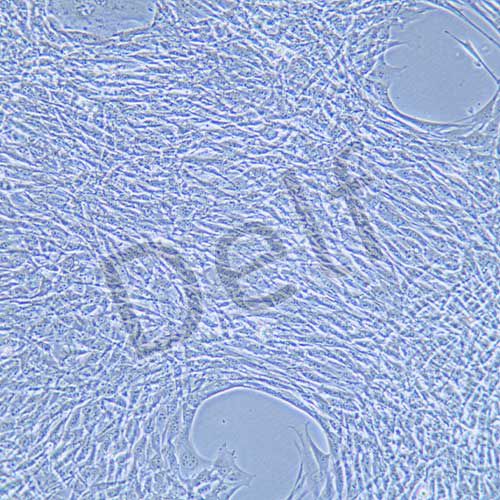 MLO-Y4 小鼠骨樣細(xì)胞（本株不供應(yīng)）