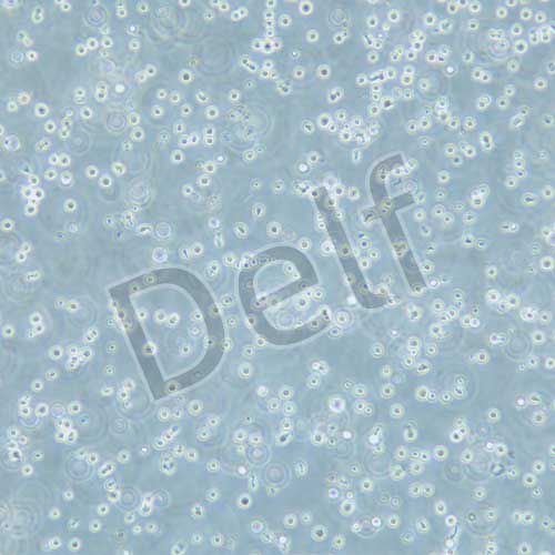 MM.1S 人多發(fā)性骨髓瘤細(xì)胞