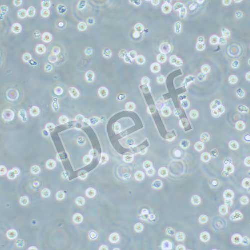MM.1S 人多發(fā)性骨髓瘤細(xì)胞