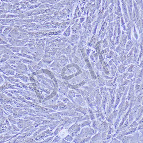 MOVAS 小鼠主動脈血管平滑肌細胞