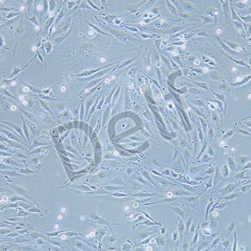 MS1 小鼠胰島內(nèi)皮細(xì)胞