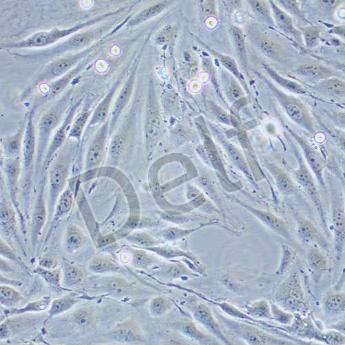 MS1 小鼠胰島內(nèi)皮細(xì)胞