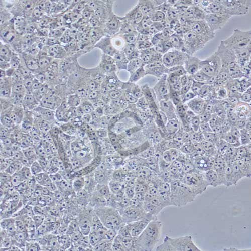 MS751 人子宮頸表皮癌細(xì)胞