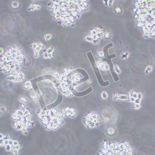 MT-4 人急性淋巴母細(xì)胞白血病細(xì)胞