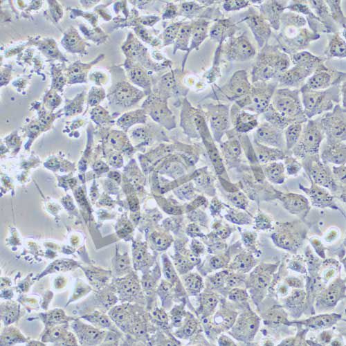 MUM2B 人侵襲性脈絡膜黑色素瘤細胞
