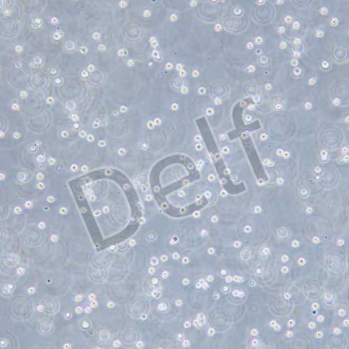 MV-4-11 人髓性單核細胞白血病細胞