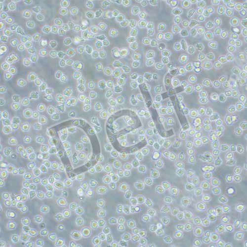 NALM-6 人B淋巴白血病細(xì)胞